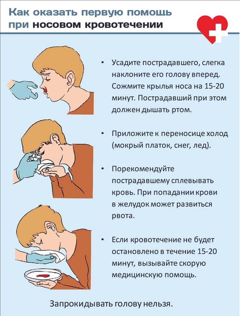 Частые кровотечения из носа: в чем причины и что делать? | Москва